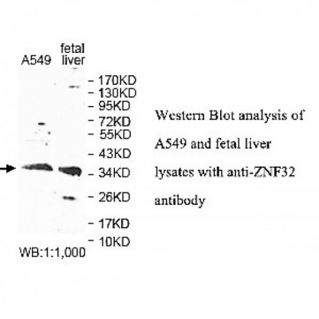 ZNF32 Antibody