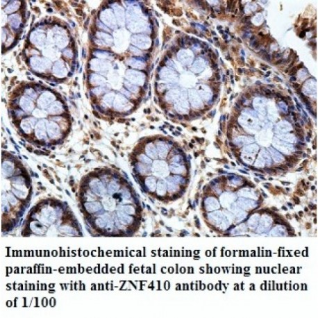 ZNF410 Antibody