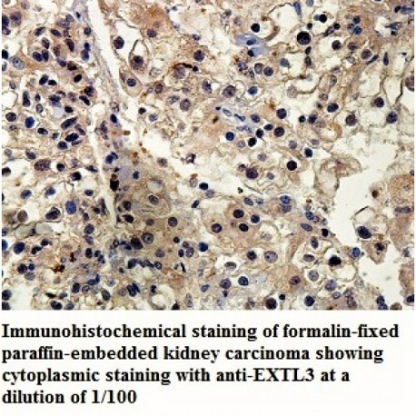 EXTL3 Antibody