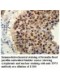 TP73 Antibody