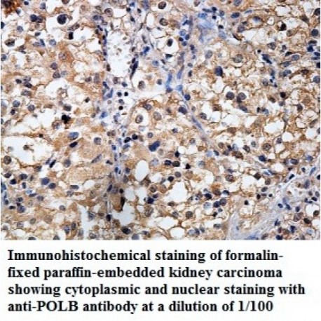 POLB Antibody