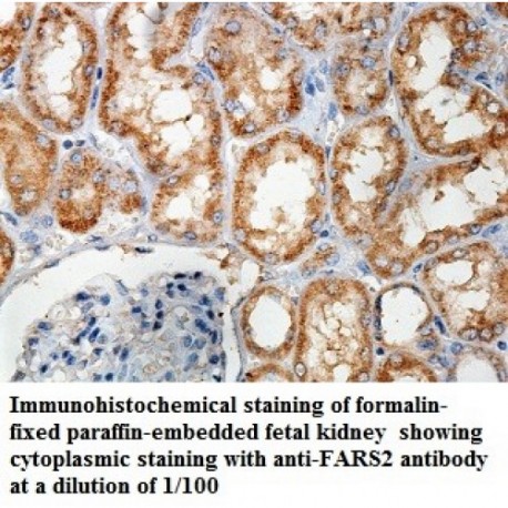 FARS2 Antibody