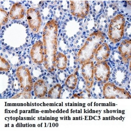 FARSB Antibody