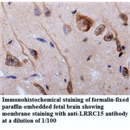 LRRC15 Antibody