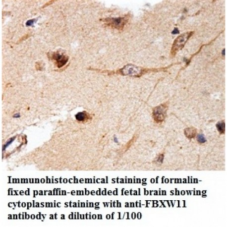 FBXW11 Antibody