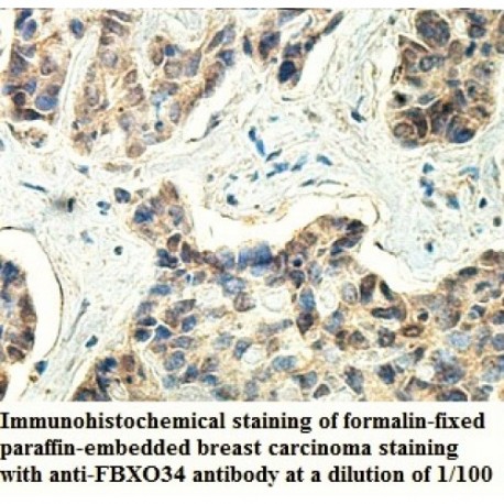 FBXO34 Antibody