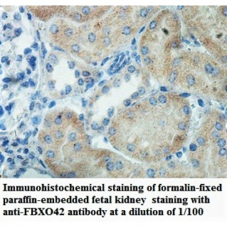 FBXO42 Antibody