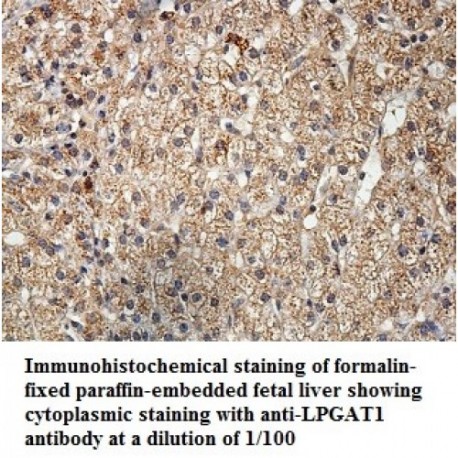 LPGAT1 Antibody