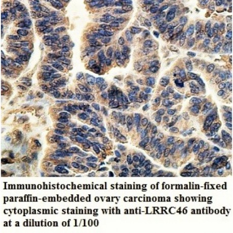 LRRC46 Antibody