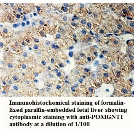 POMGNT1 Antibody