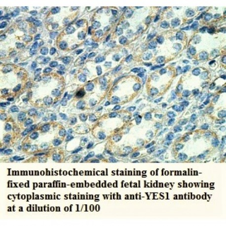 YES1 Antibody