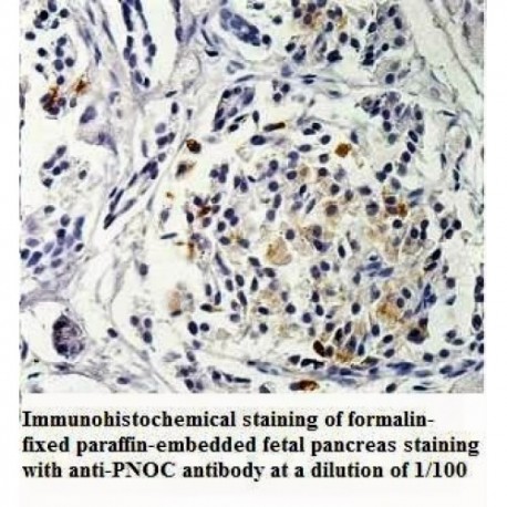 PNOC Antibody