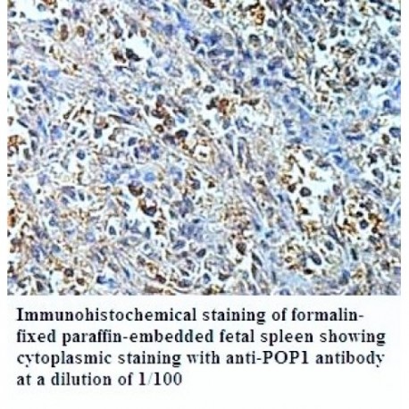 POP1 Antibody