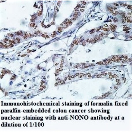 NONO Antibody