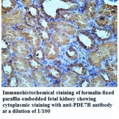 PDE7B Antibody