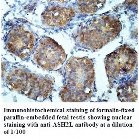 ASH2L Antibody