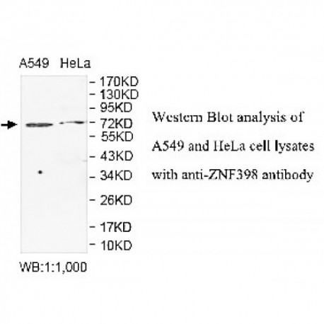 ZNF398 Antibody