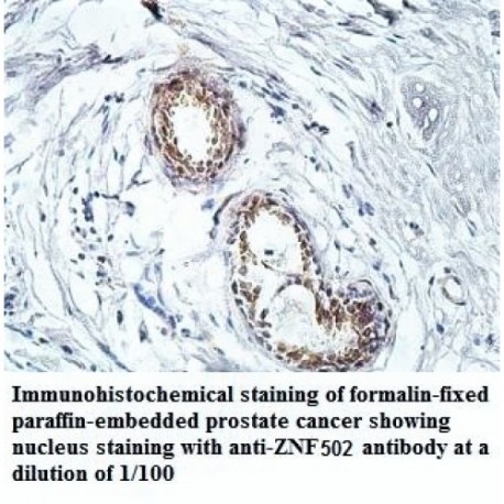 ZNF502 Antibody