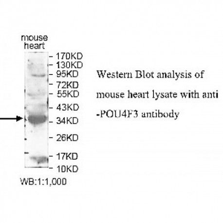 POU4F3 Antibody