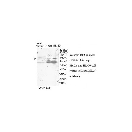 ZNF582 Antibody