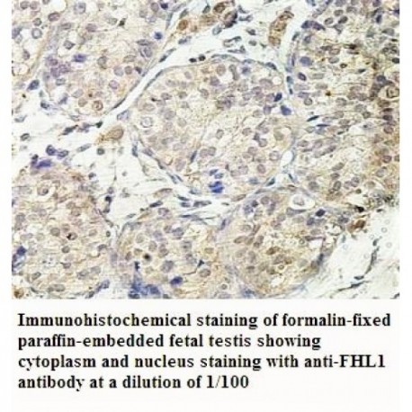 FHL1 Antibody