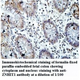 ZNHIT1 Antibody