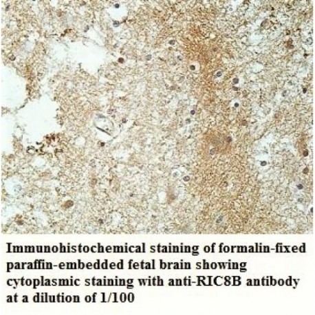 RIC8B Antibody