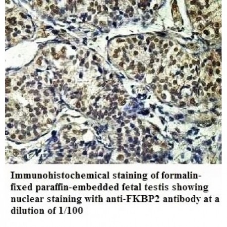 FKBP2 Antibody