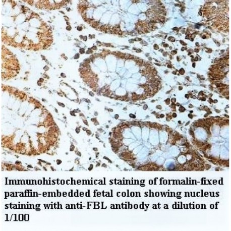 FBL Antibody