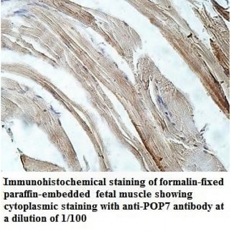 POP7 Antibody