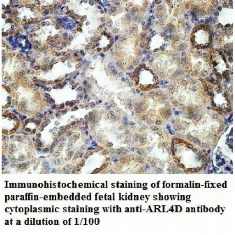 ARL4D Antibody