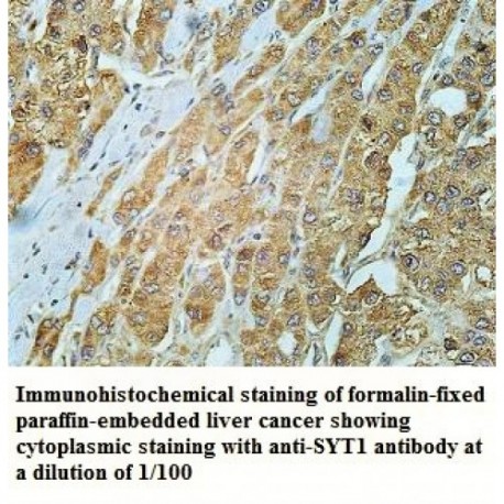 SYT1 Antibody