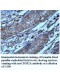 TOP2A Antibody