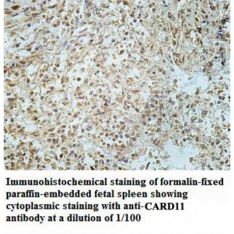 CARD11 Antibody