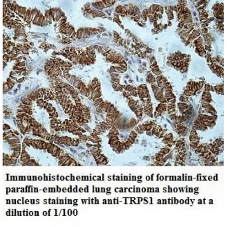 TRPS1 Antibody