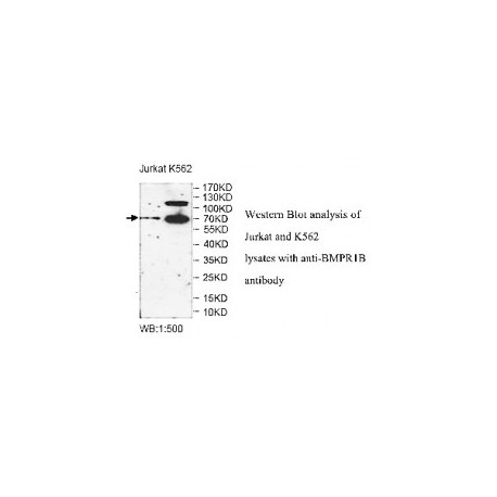 ZNF595 Antibody