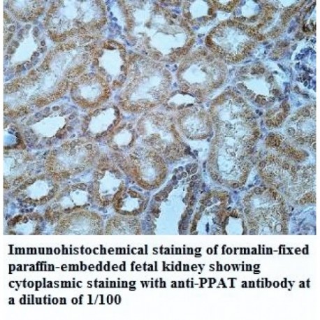 PPAT Antibody