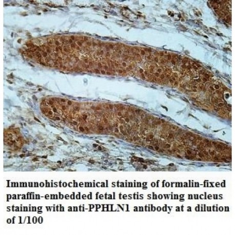 PPHLN1 Antibody