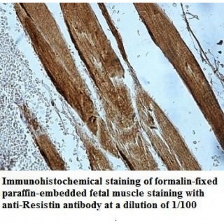 Resistin Antibody