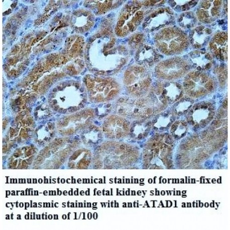 ATAD1 Antibody