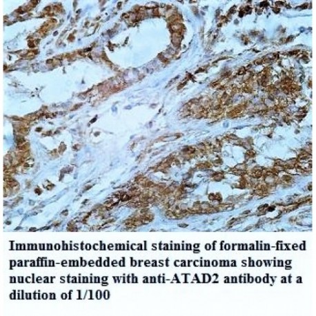 ATAD2 Antibody