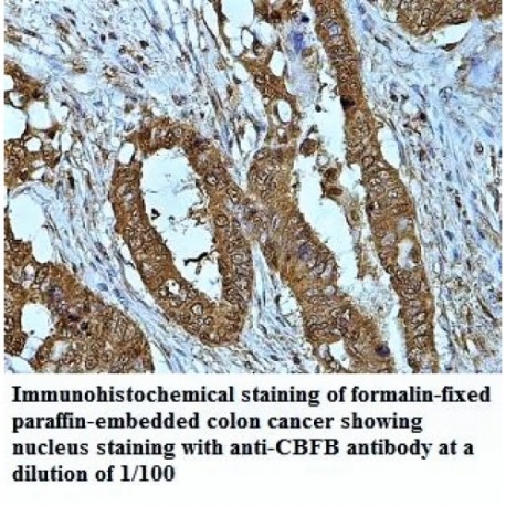 CBFB Antibody