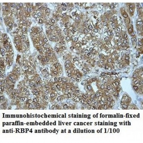 RBP4 Antibody