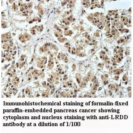 LRDD Antibody