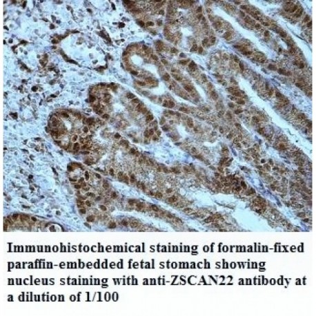 ZSCAN22 Antibody