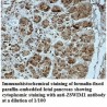 ZSWIM1 Antibody