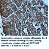 ZSWIM2 Antibody