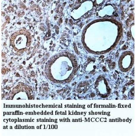 MCCC2 Antibody