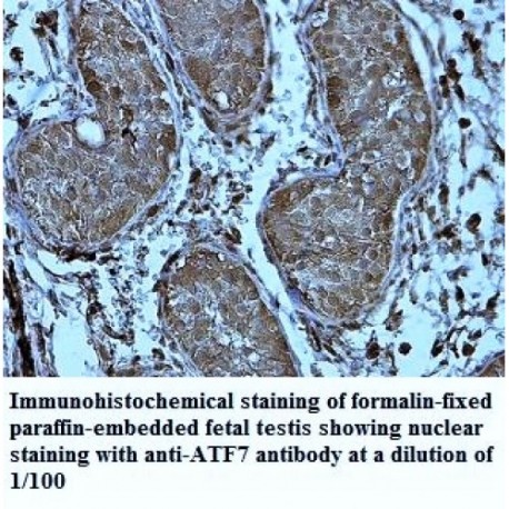 ATF7 Antibody