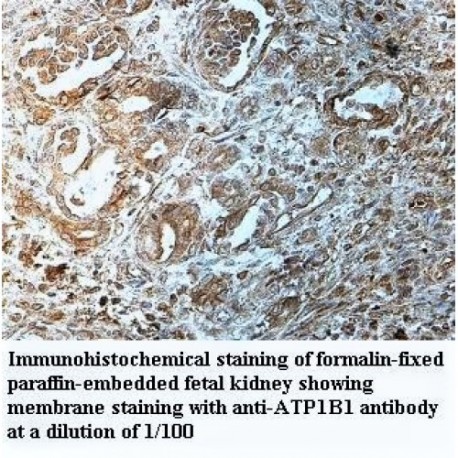 ATP1B1 Antibody